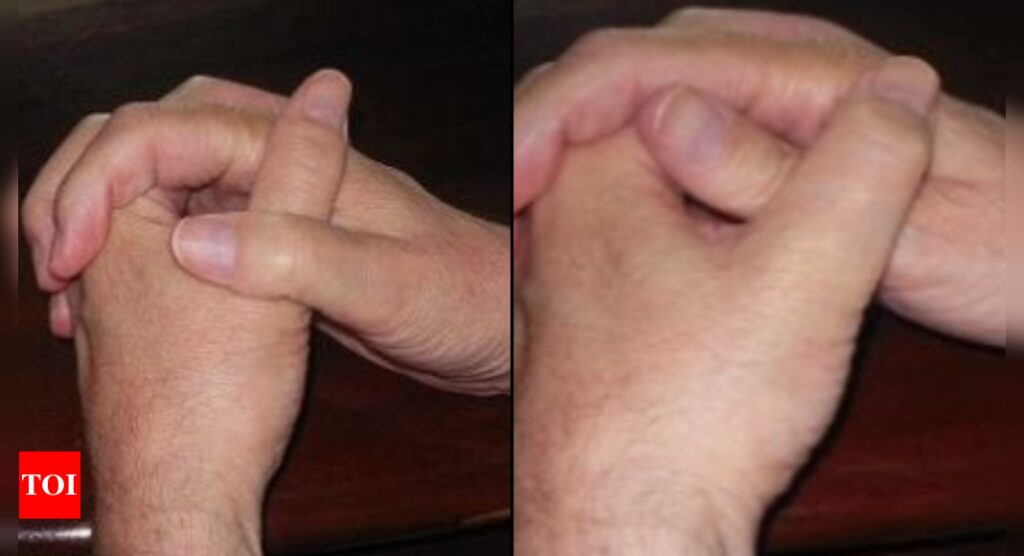 Personality test: How you cross your thumbs together when clasping hands can reveal a lot about your personality